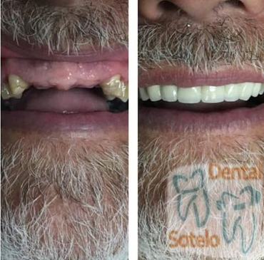 Slider image (6) Dental Sotelo